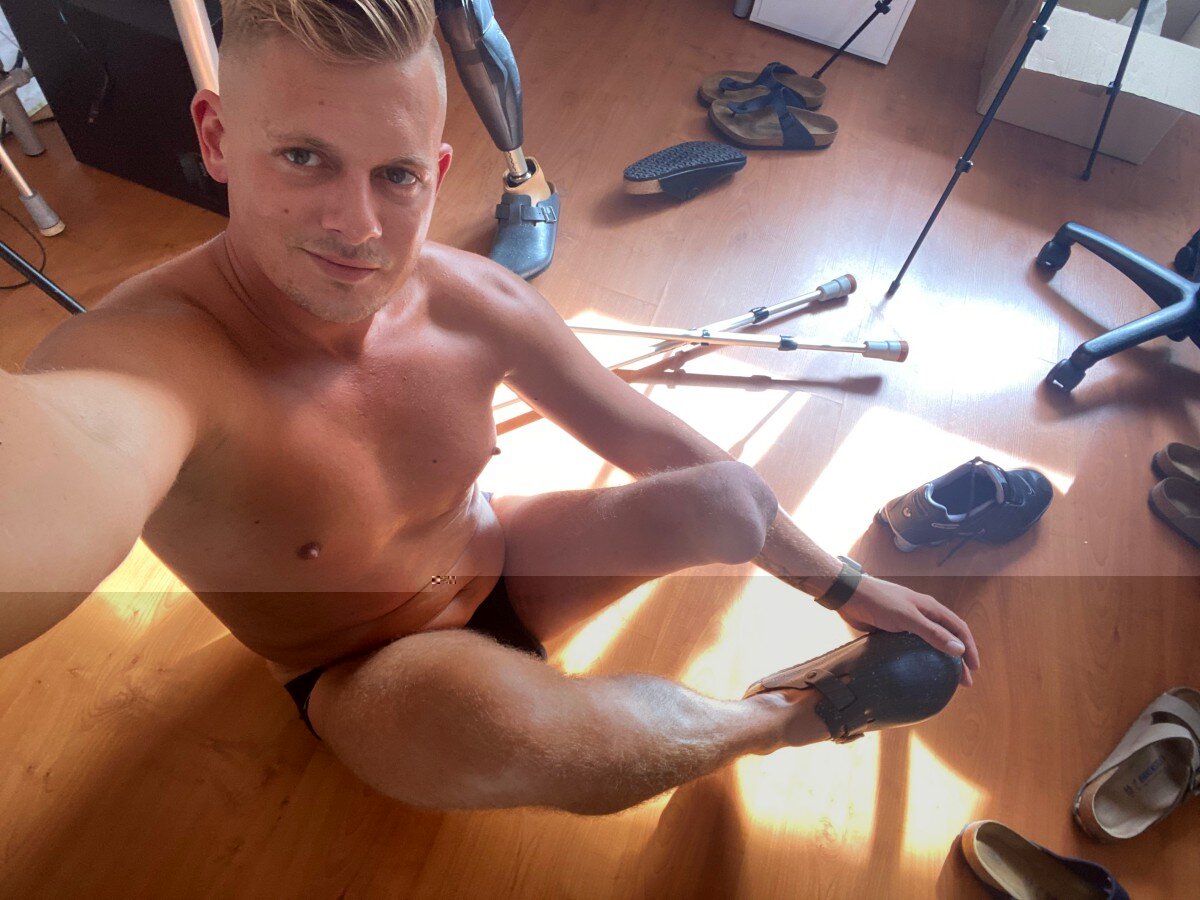 Amputeeboy (@amputeeboy), OnlyFans creator